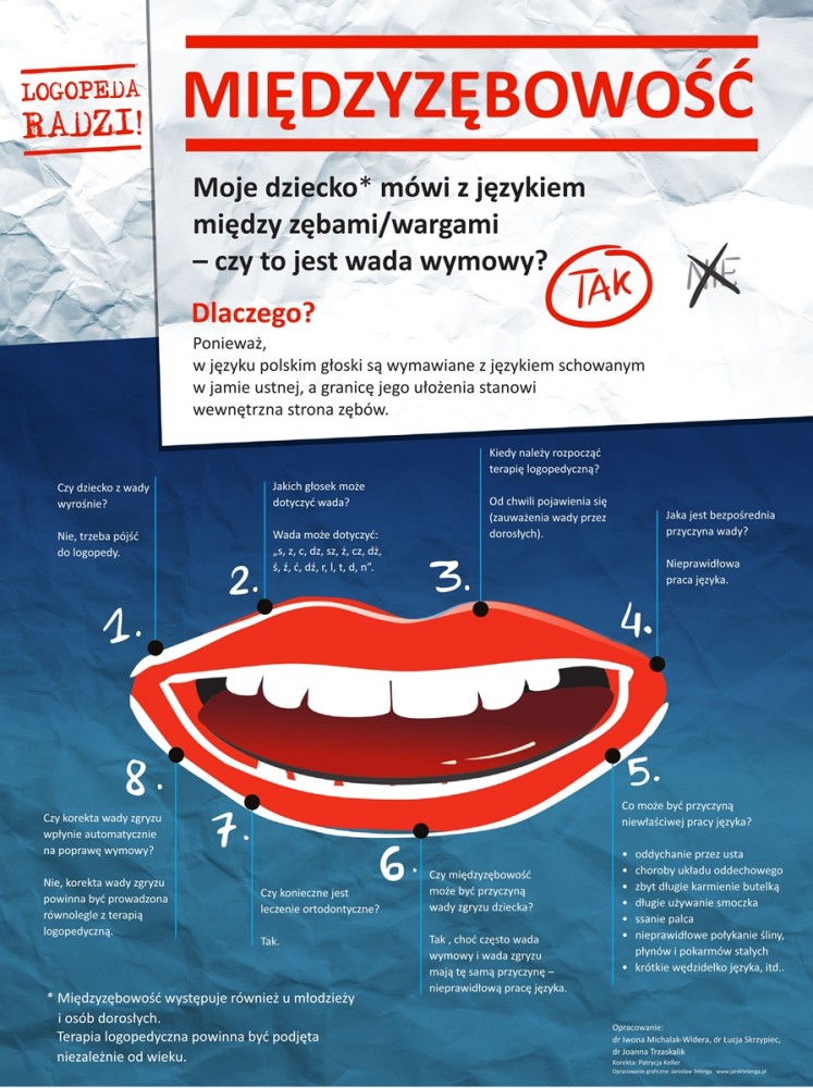 Międzyzębowość