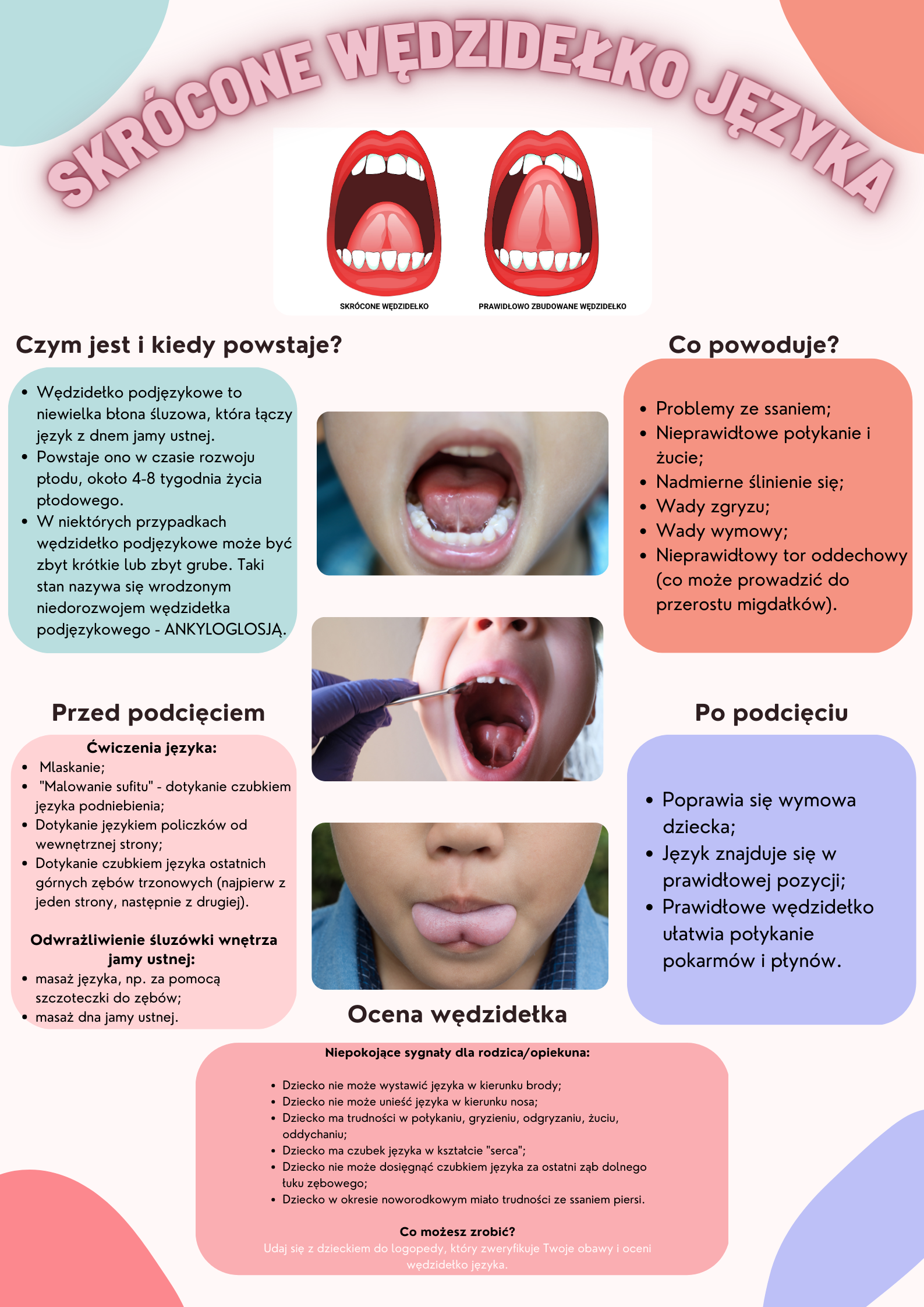 Informacje o skróconym wędzidełku języka.